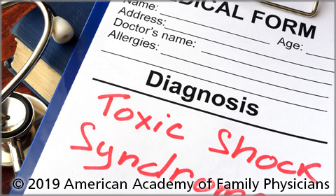 Streptococcal Toxic Shock Syndrome After Insertion of a Levonorgestrel